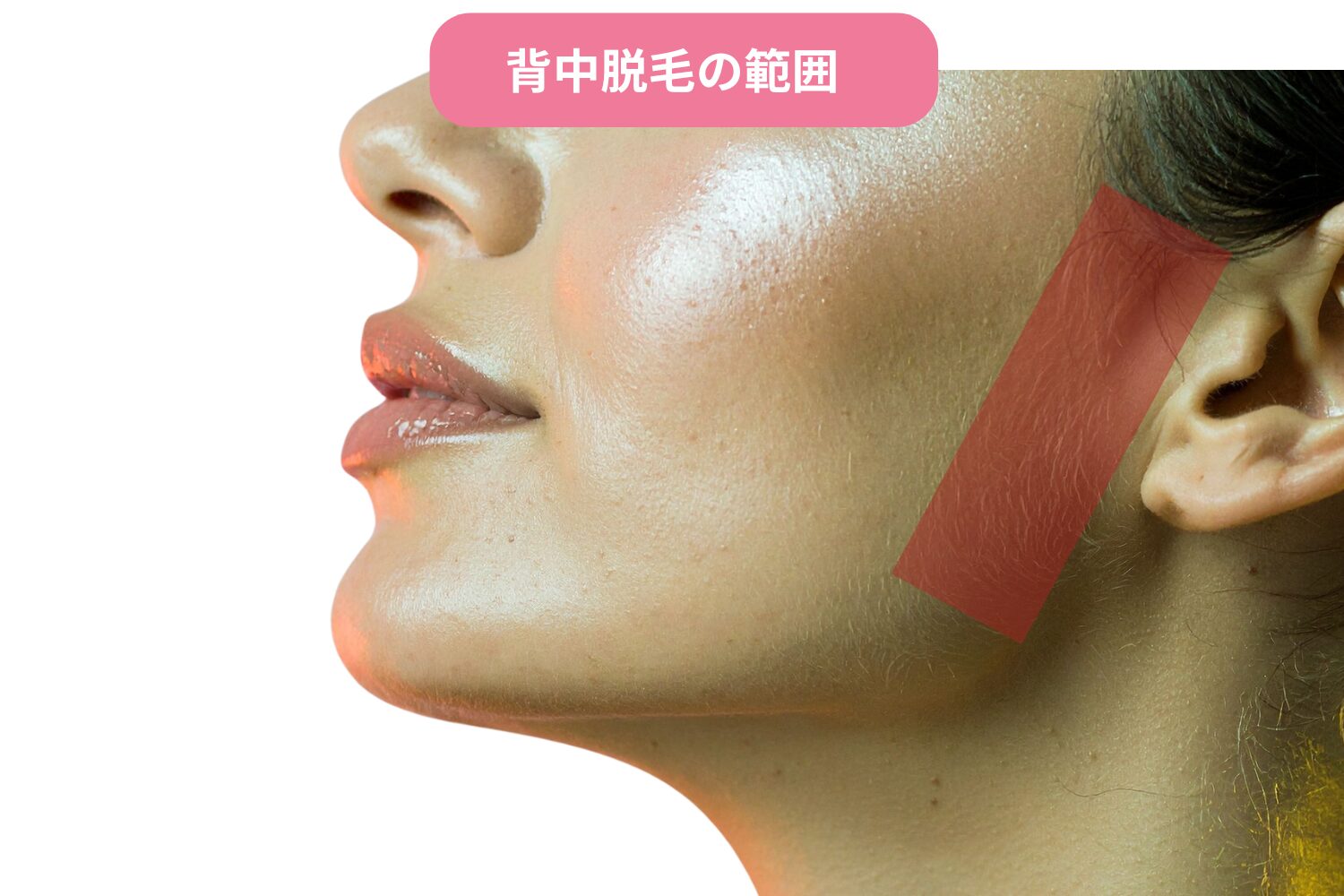 もみあげ脱毛とは？