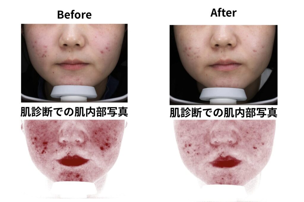 1回でも変化を感じる人は多い