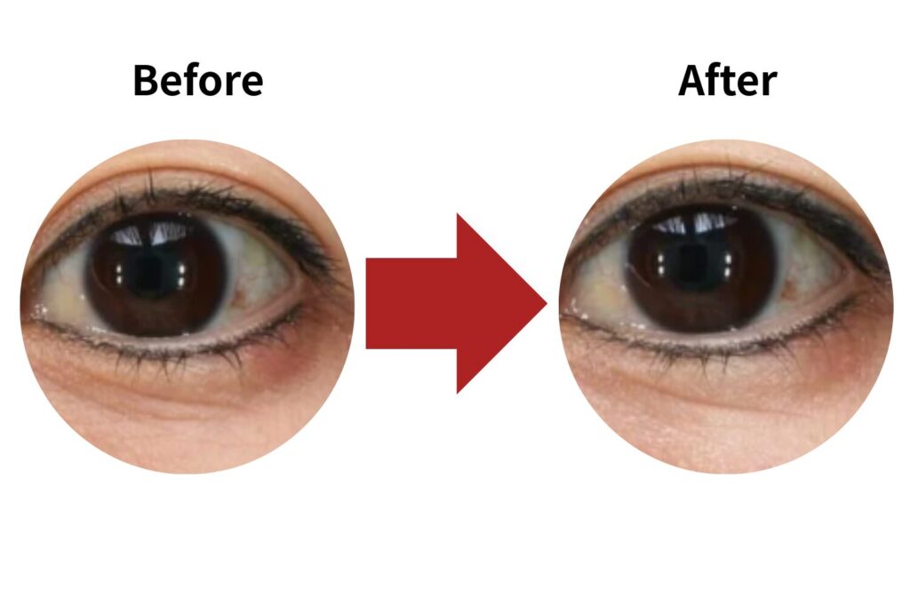 小じわ・ハリの改善