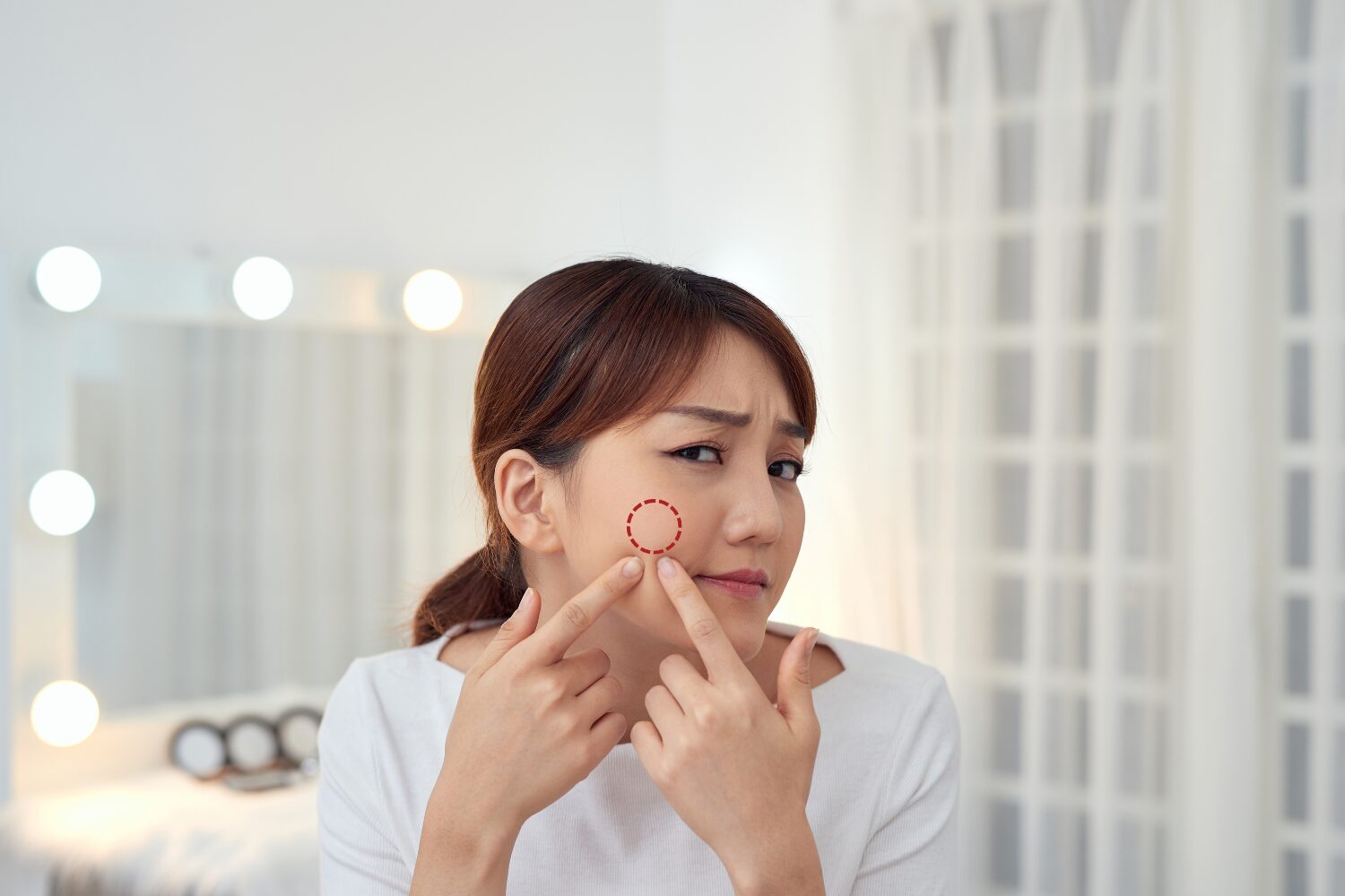 ニキビパッチの効果とは?種類・使い方・注意点を解説