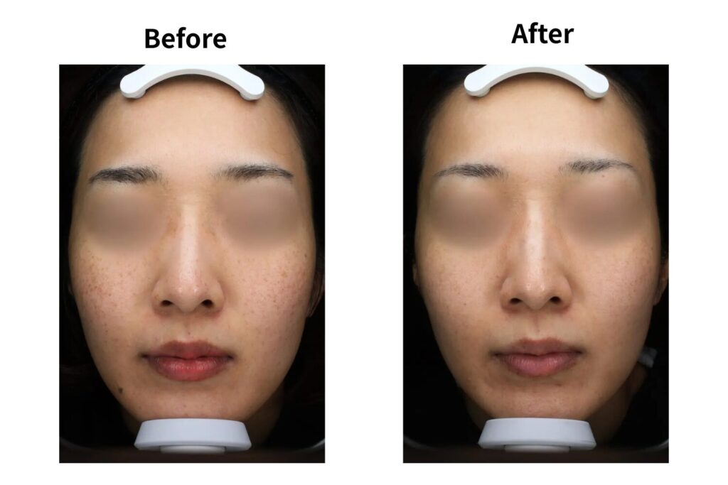 1回目の施術で感じやすい変化