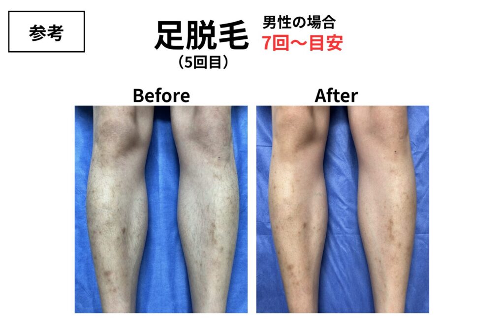 効果はどこまで残る?