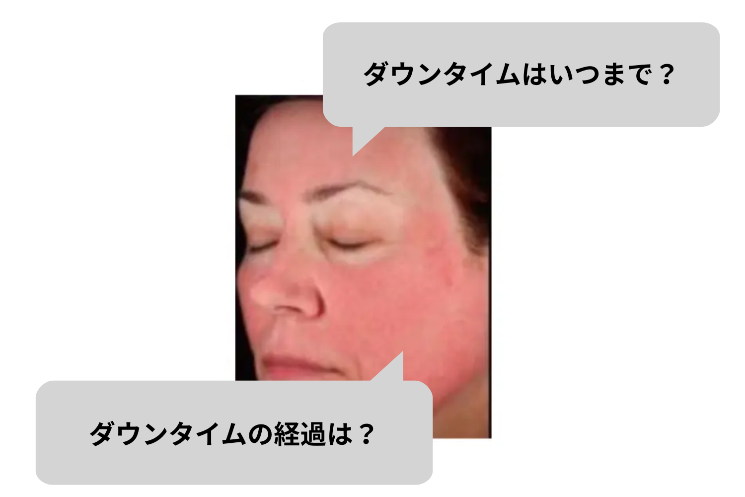 ピコフラクショナルのダウンタイムは何日?症状や経過・注意点を解説