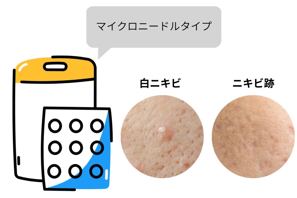 マイクロニードルタイプ