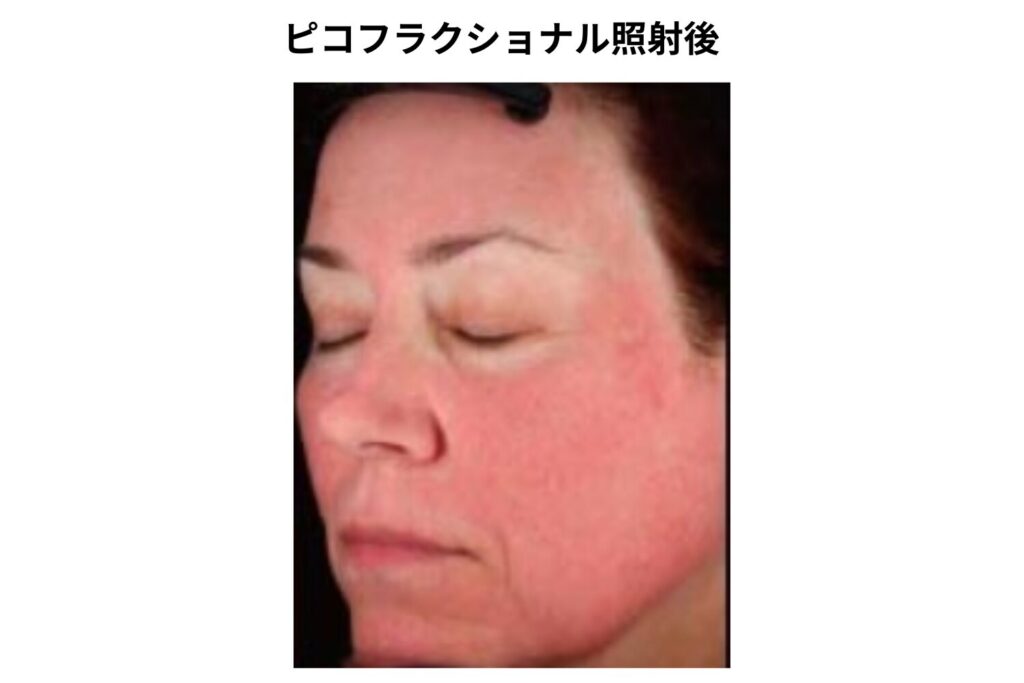 施術直後に起こりやすい症状