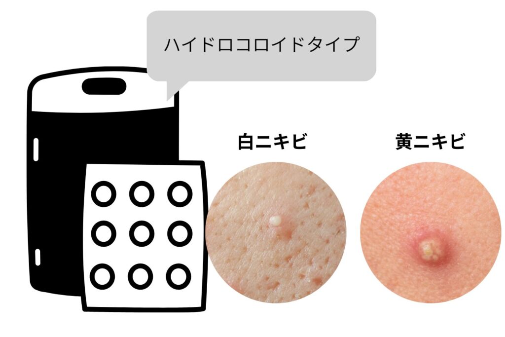 ハイドロコロイドタイプ