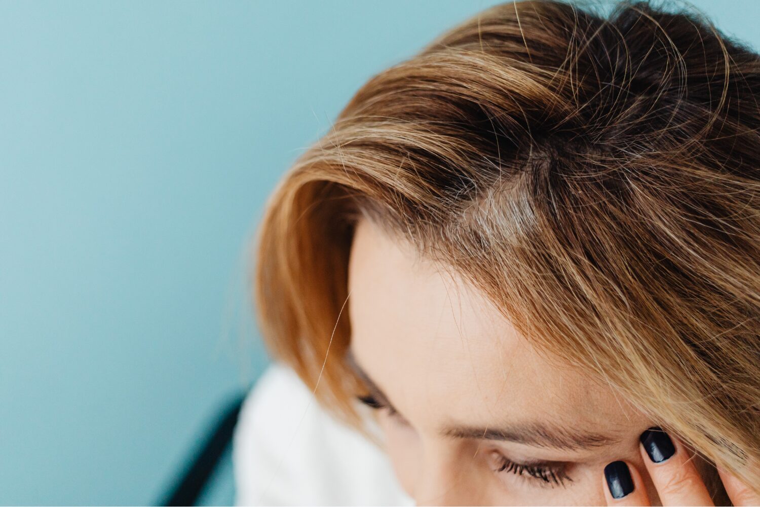 ニキビがこめかみにできる原因と治し方|悪化を防ぐ対策まで解説