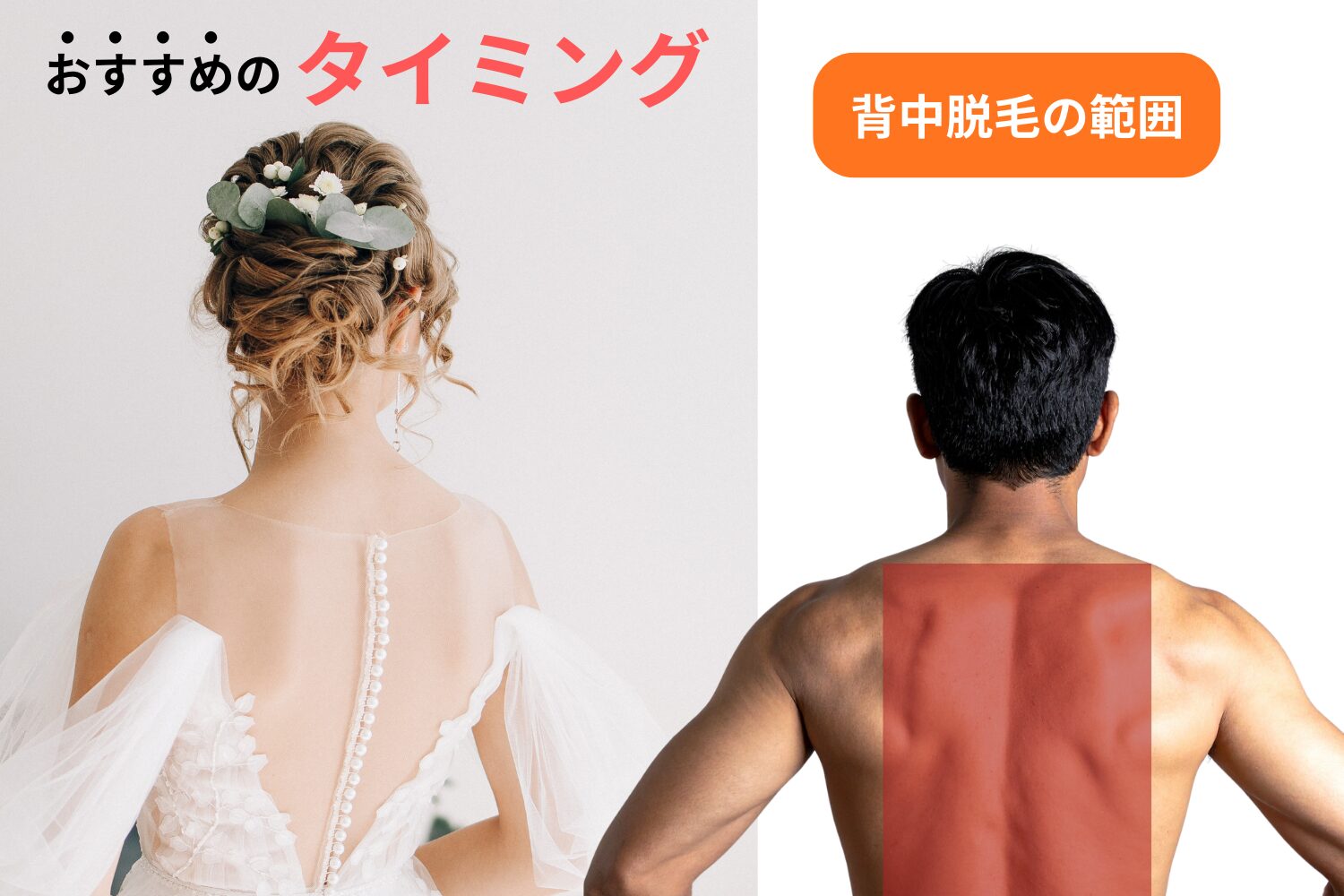 背中脱毛とは？