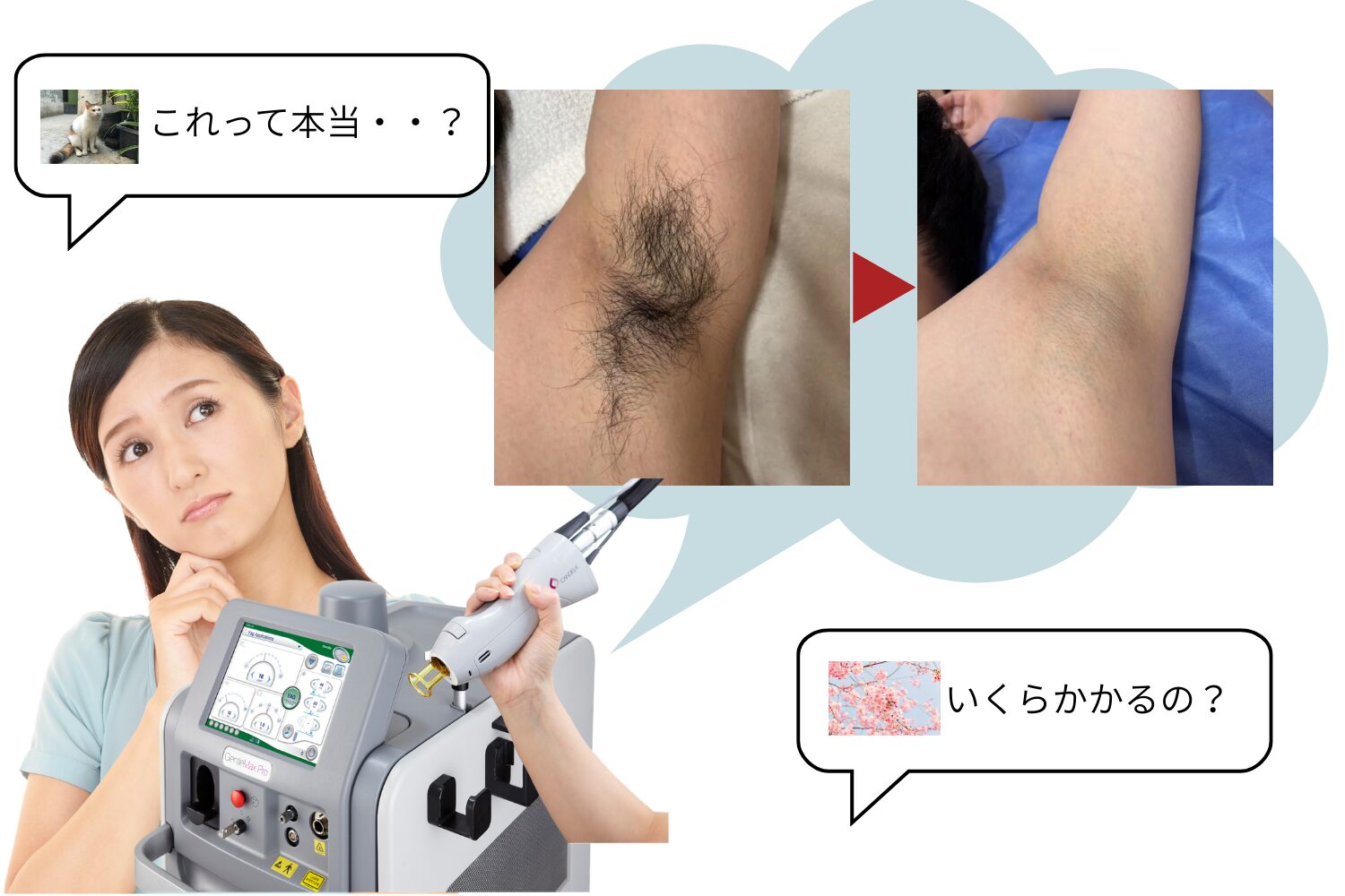 医療脱毛ぶっちゃけ効果ある？回数・料金・痛みを解説