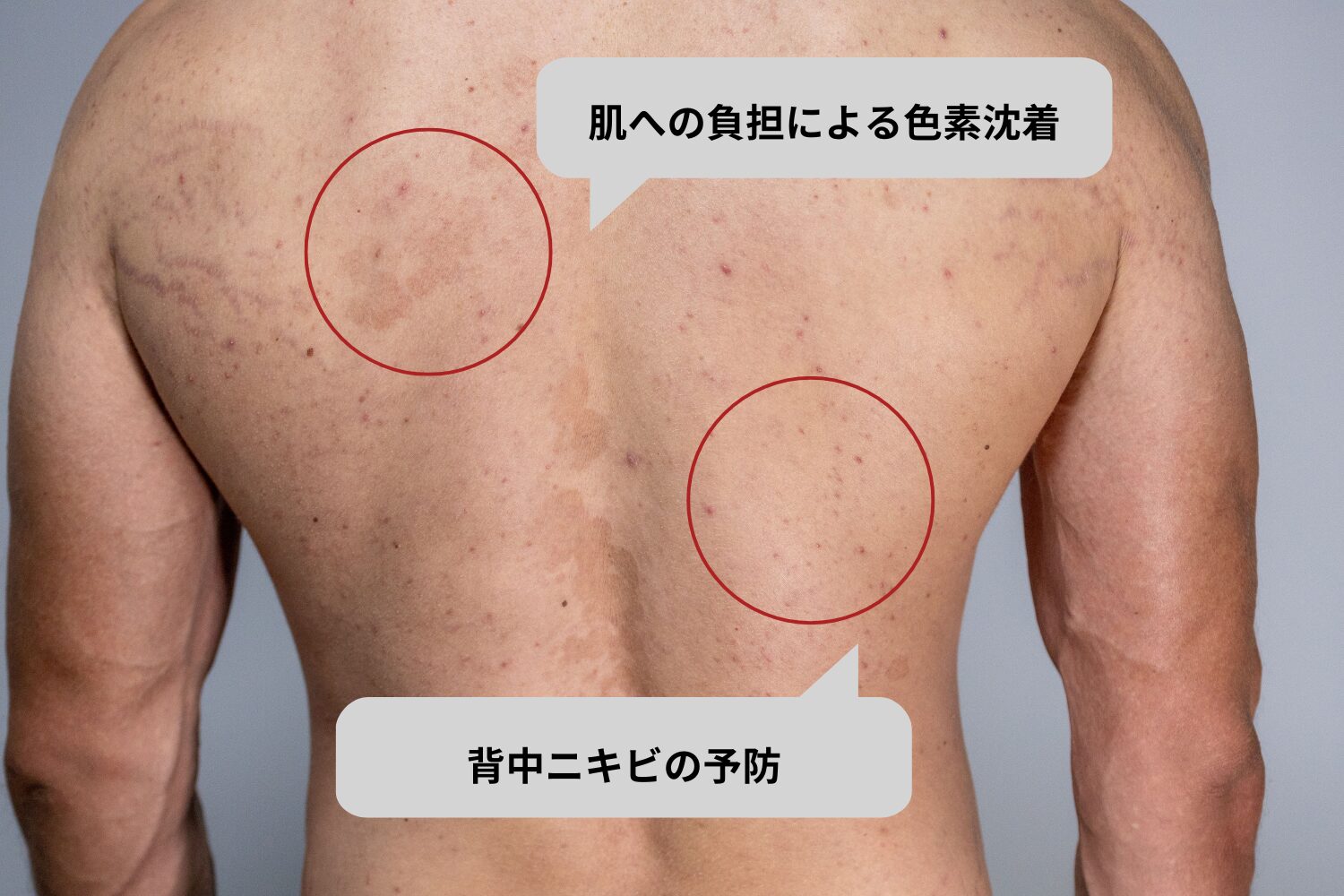 肌トラブルの予防につながる