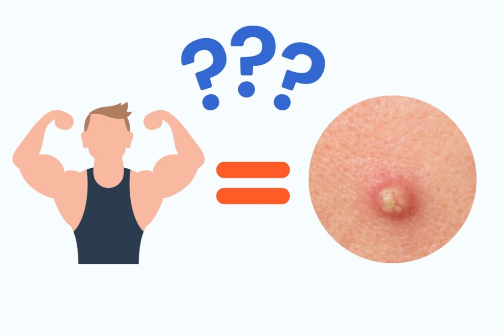 ニキビとテストステロンの関係|原因と対策を解説