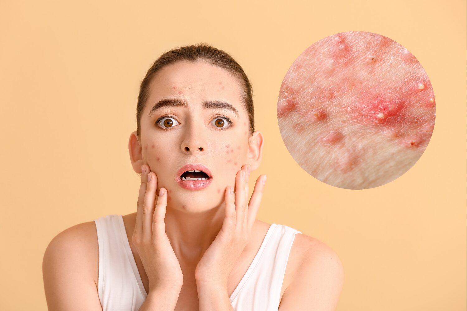 ニキビができやすい原因とは?生活習慣・肌質・正しい対策を医師が解説