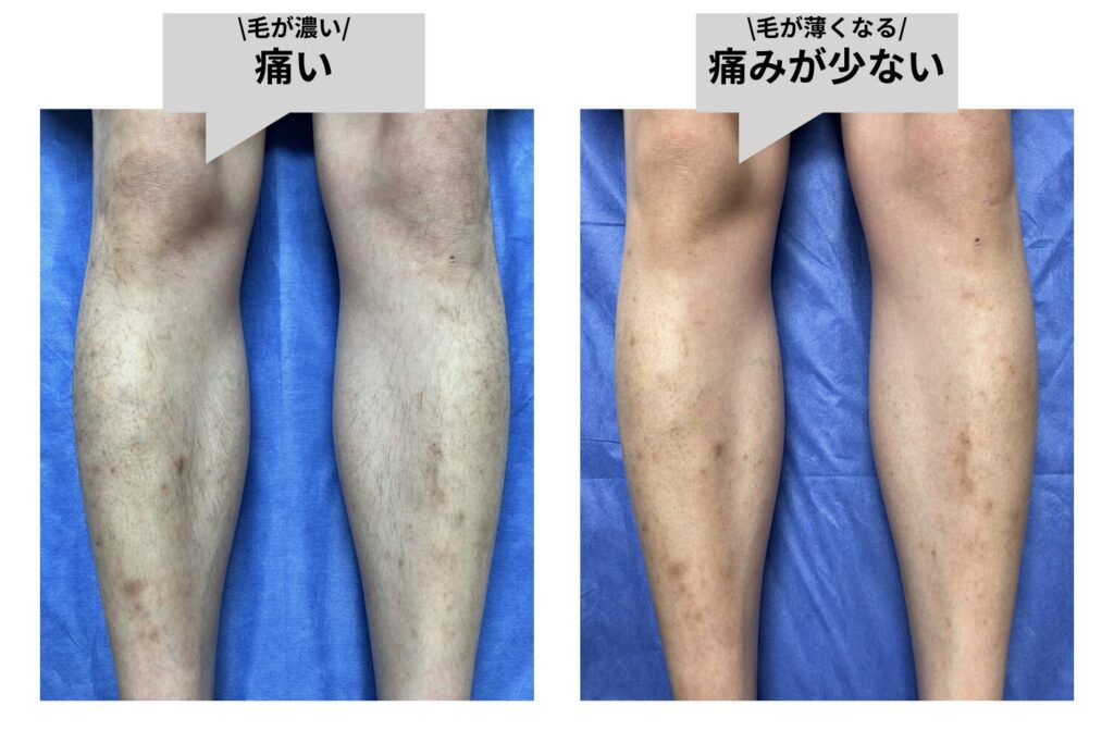 痛みが出やすいケース