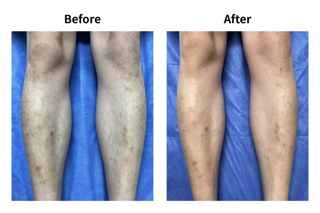 毛量を調整しやすい