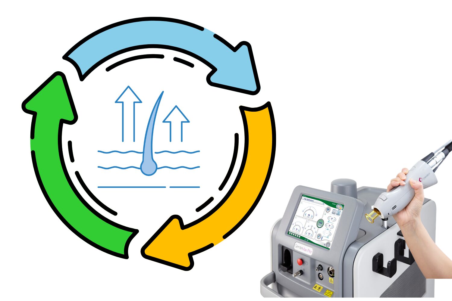 毛周期とは？脱毛効果を高める仕組みを解説
