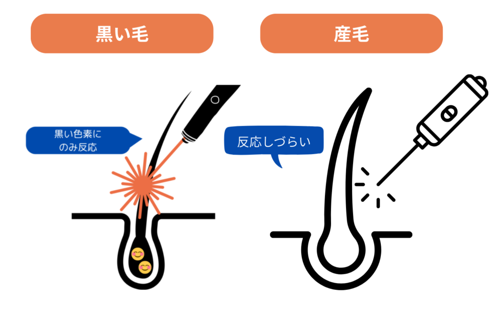 産毛が脱毛しにくい理由