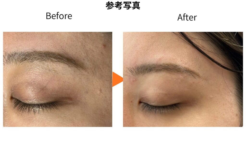 肌がきれいに見える