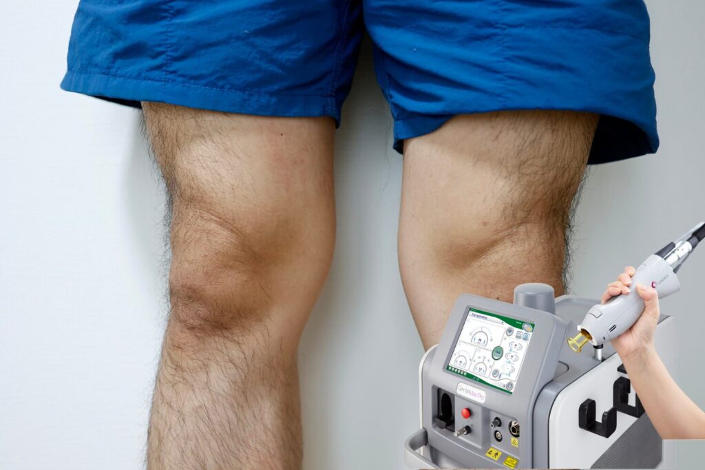 メンズのすね毛脱毛ガイド｜回数・費用・痛みを解説