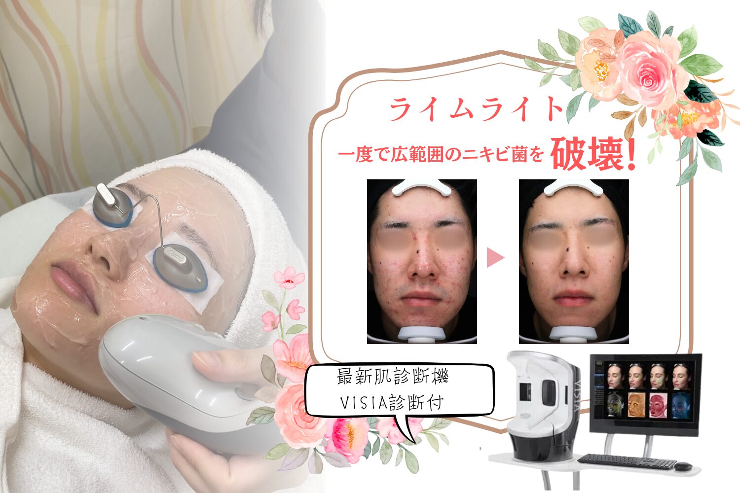 ライムライト