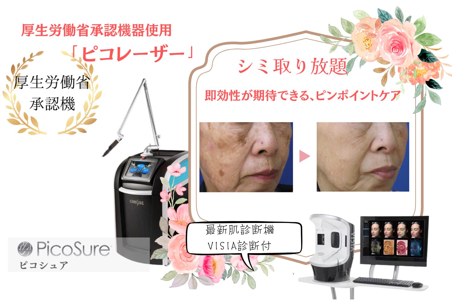 シミ取り放題