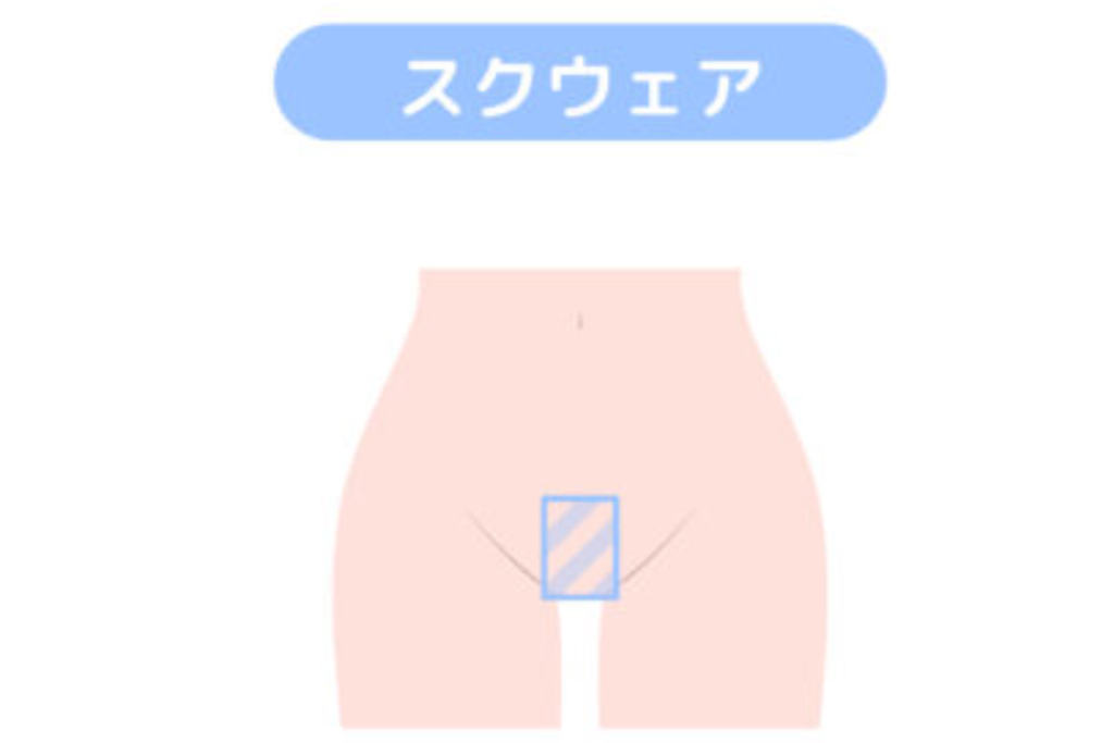 スクエアはVラインをすっきり見せたい方に人気