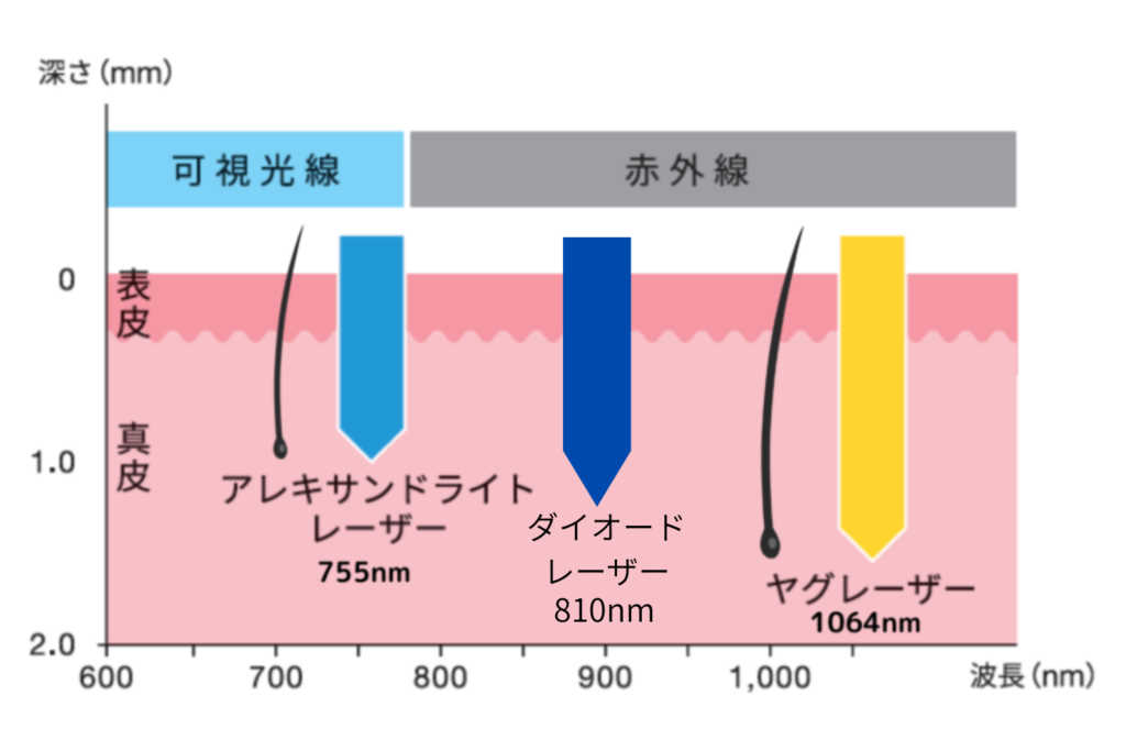 ダイオードレーザー