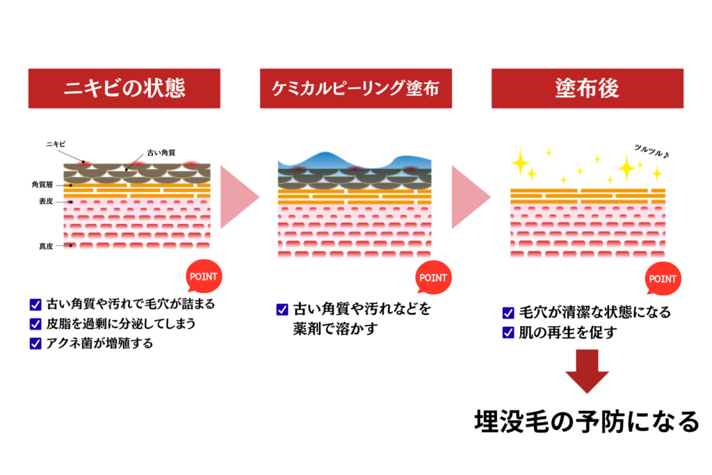 ピーリングは肌状態に合わせて使う