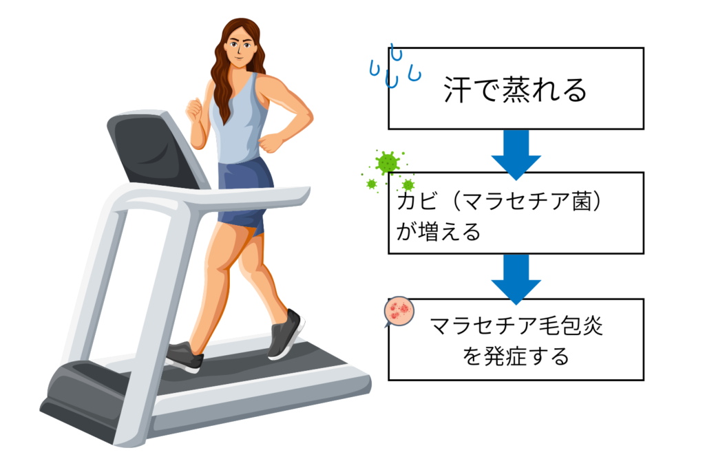 カビの一種が毛穴で増えて起こる