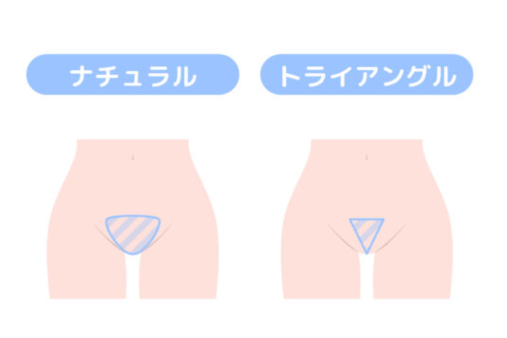 毛量調整は3〜5回が目安【ナチュラル・トライアングル向き】
