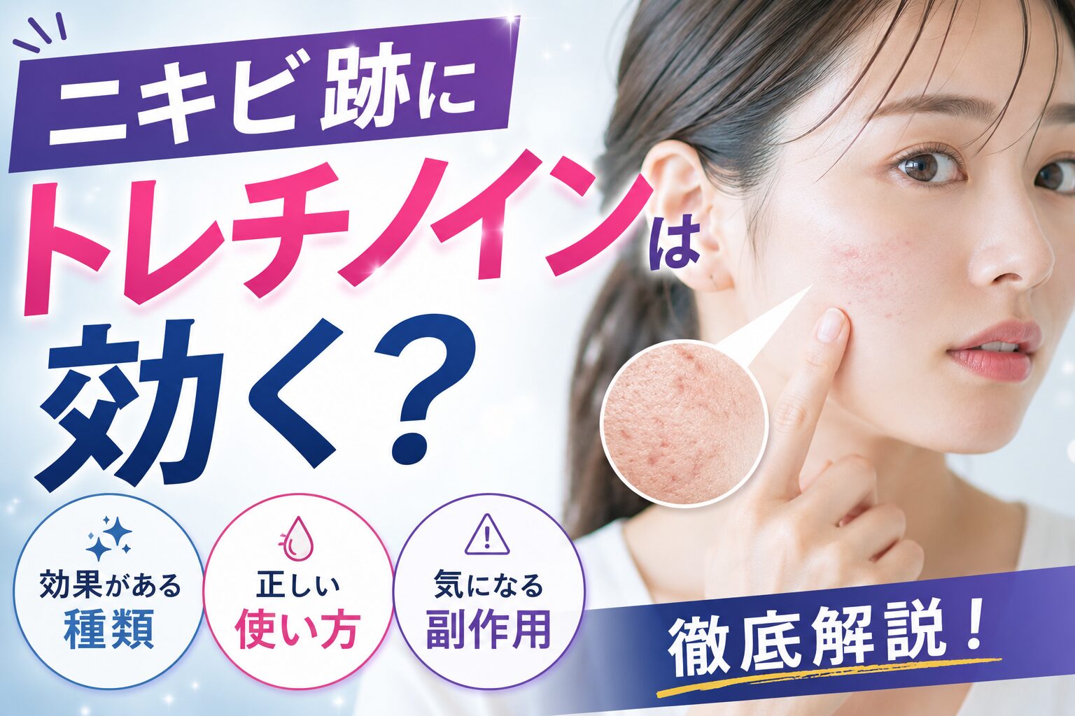 ニキビ跡にトレチノインは効く?効果がある種類・使い方・副作用を解説