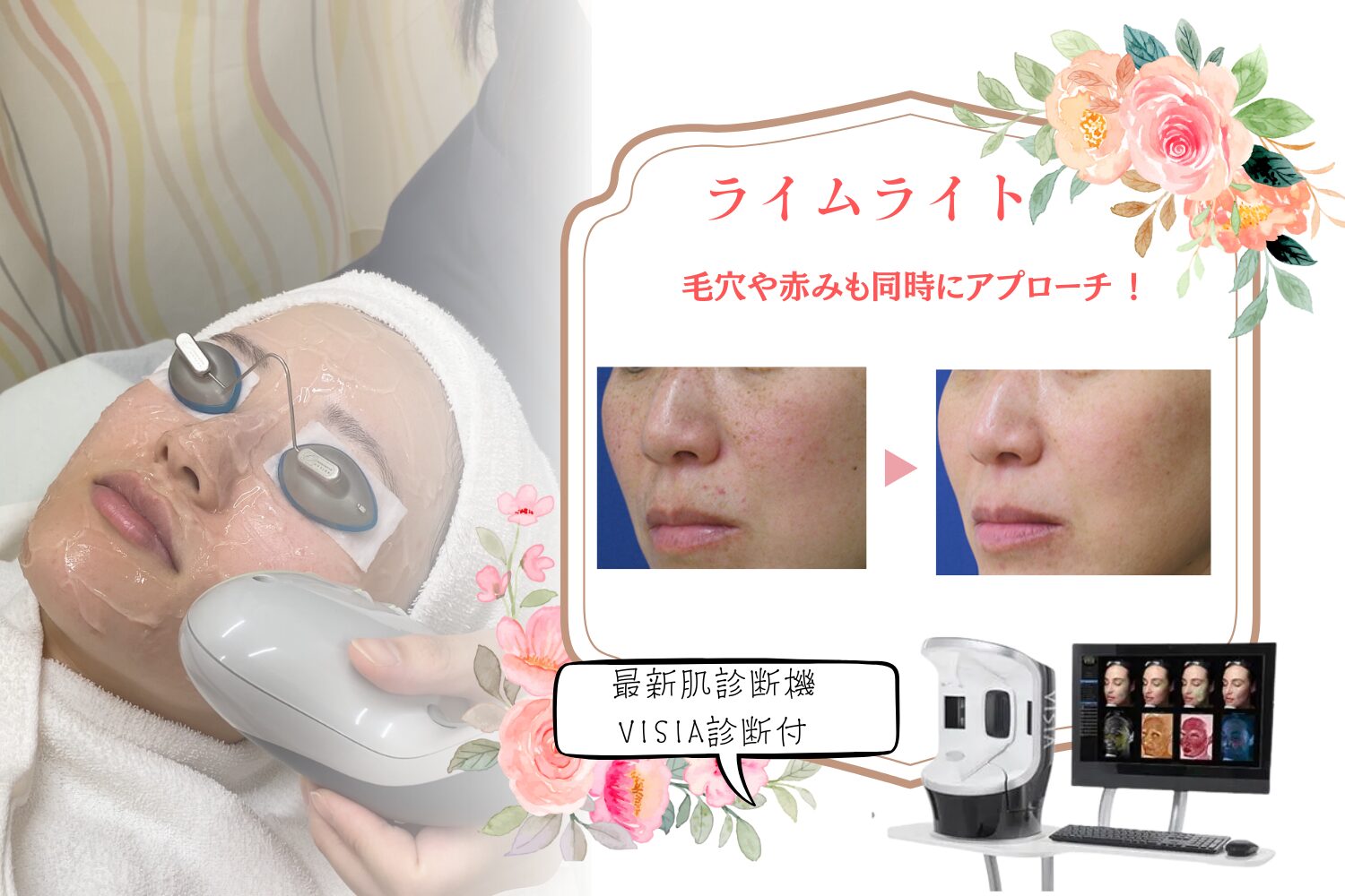 ライムライト