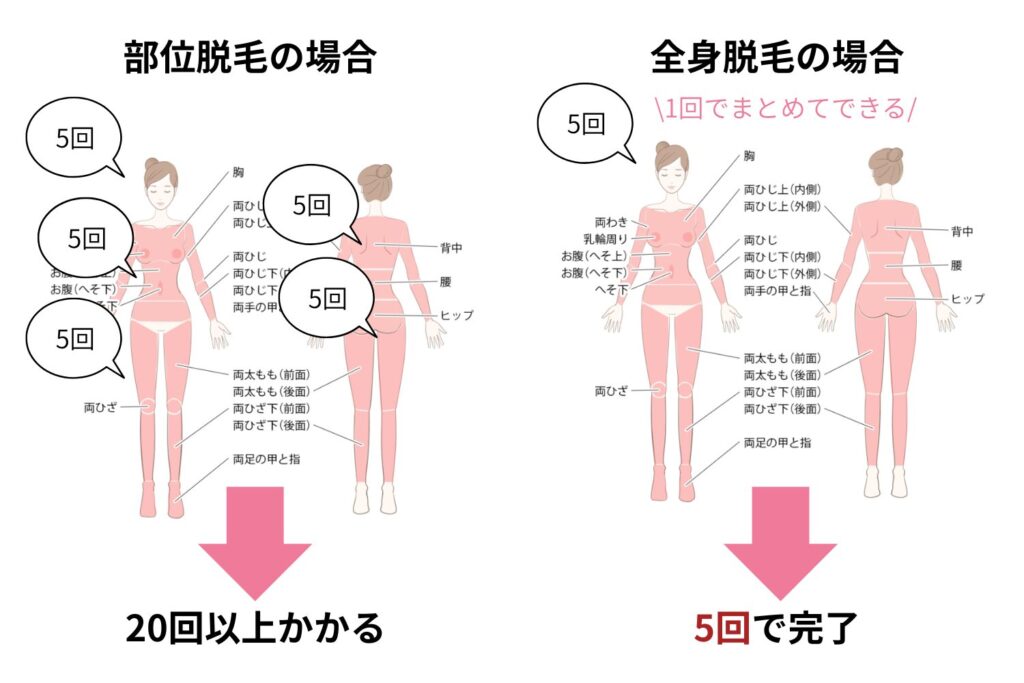 全身をまとめて効率よく脱毛できる