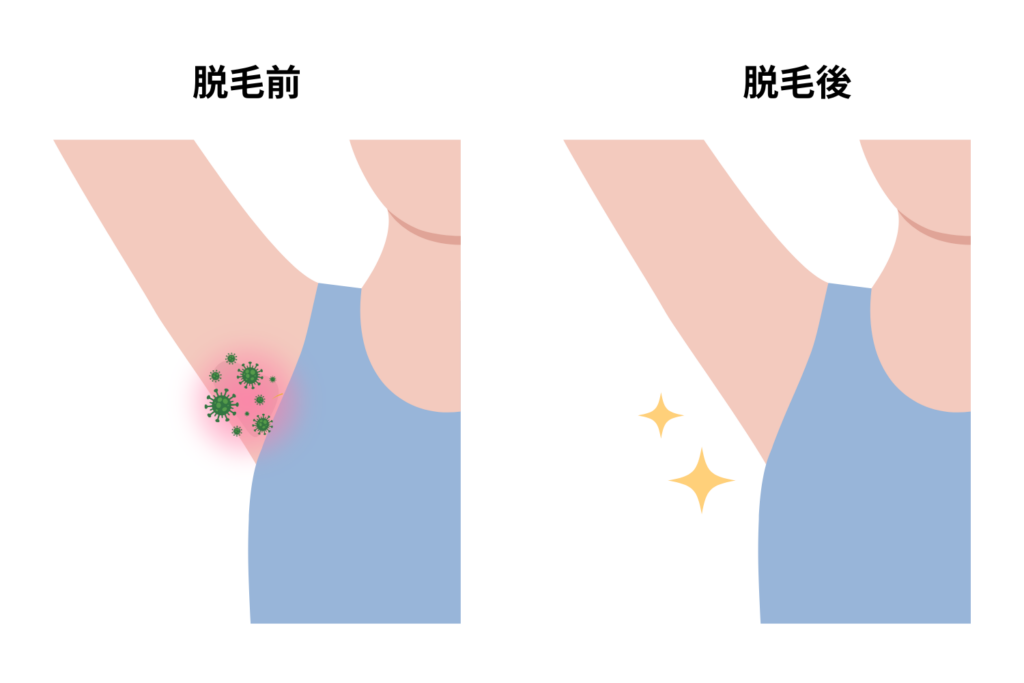 ムレや雑菌が減りやすい