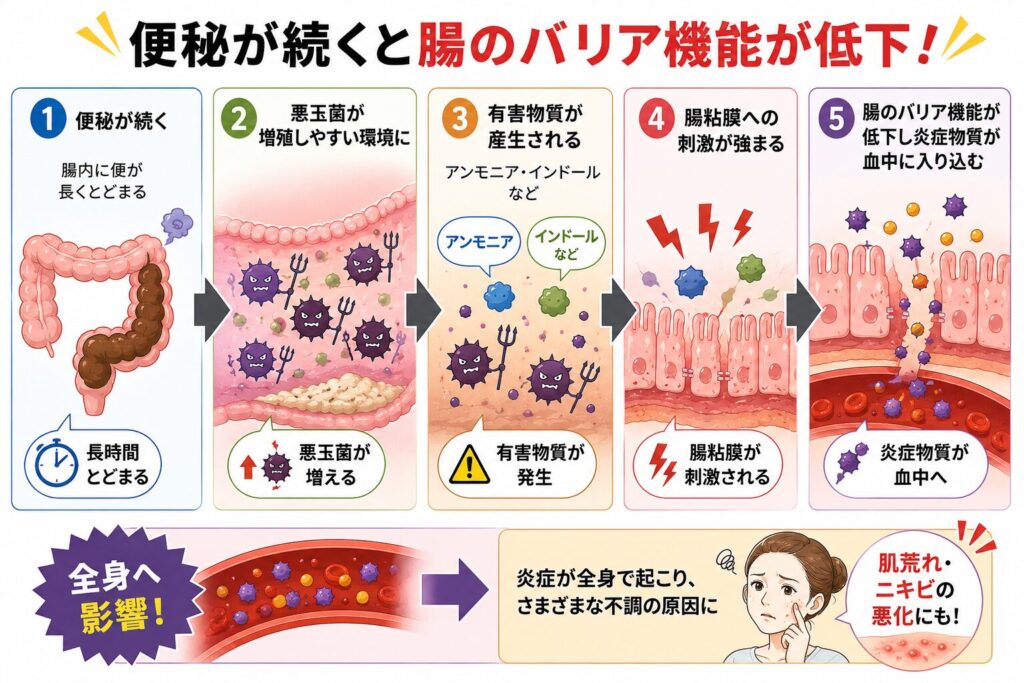 便秘で腸内に便がたまると、悪玉菌が増えやすくなる