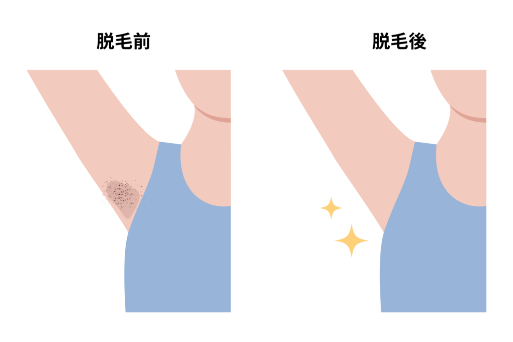 皮脂や角質がたまりにくくなる