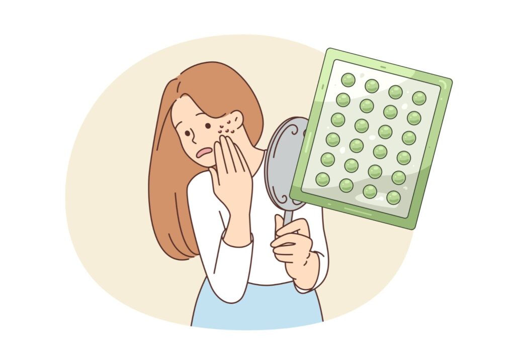 3．触れないようにニキビ用パッチで保護する