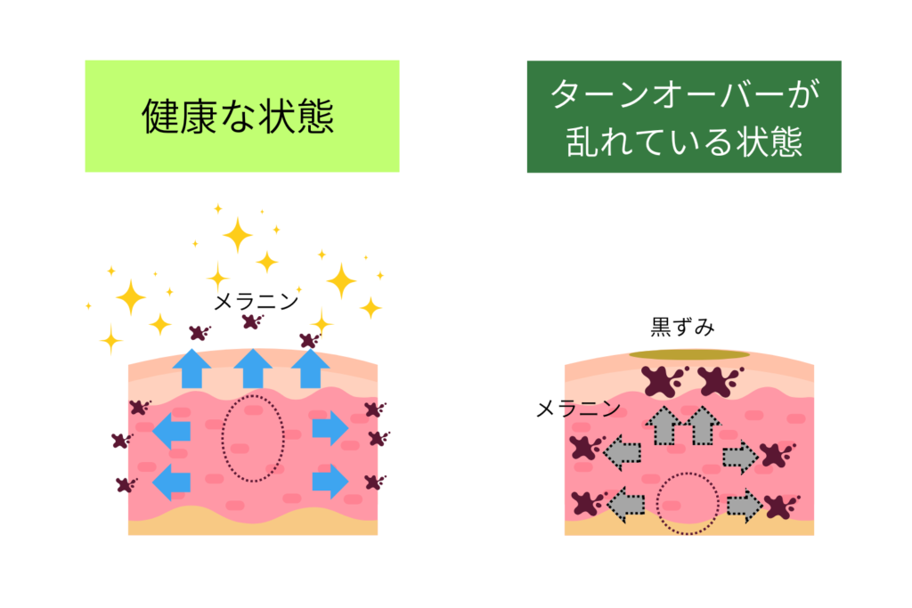 乾燥やターンオーバーの乱れ