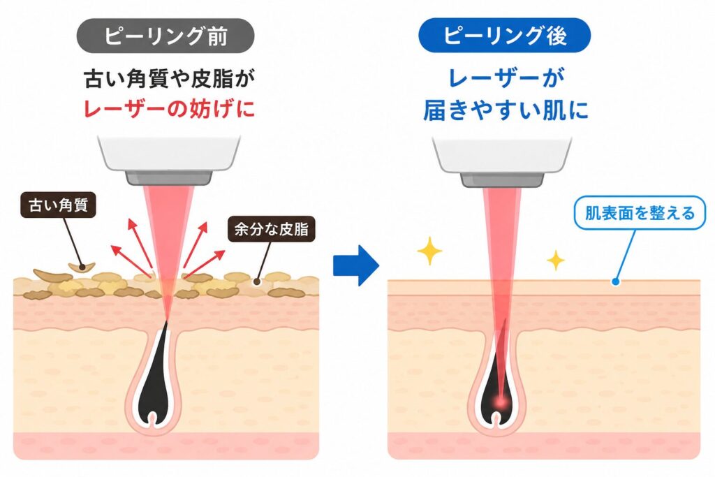 ピーリングの仕組み
