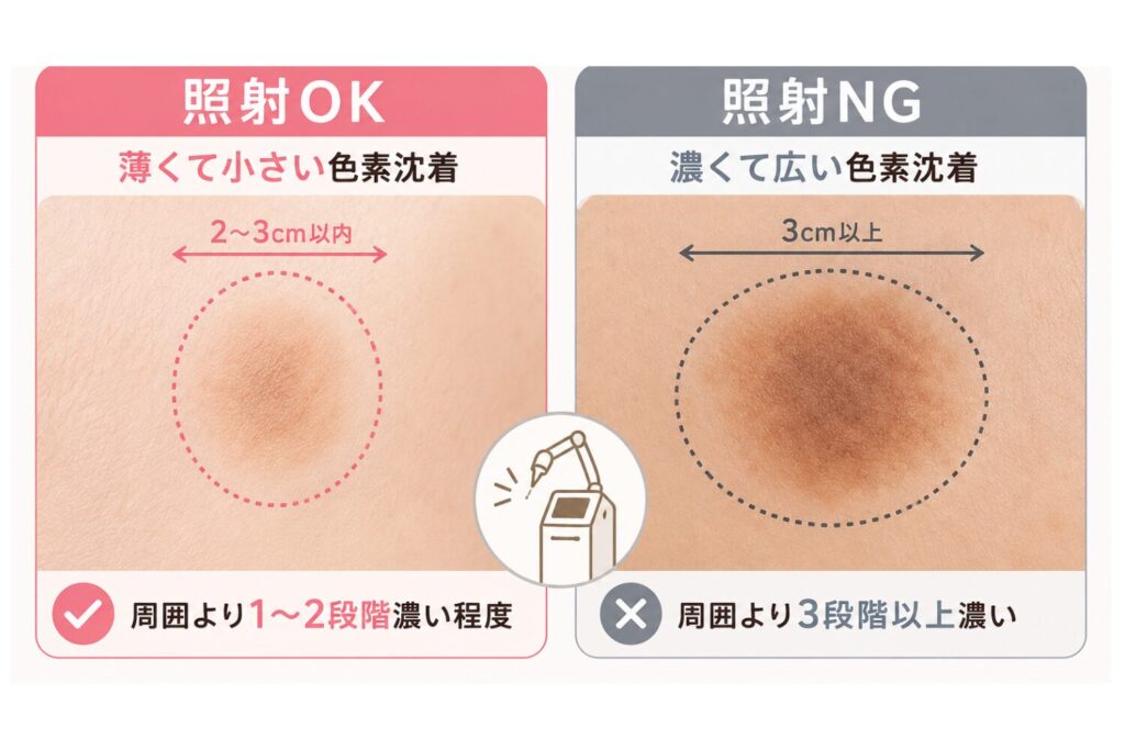 濃い色素沈着や日焼けがある場合