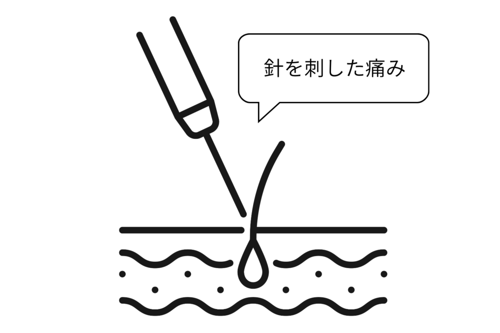 針を毛穴へ入れるときに刺激が加わる