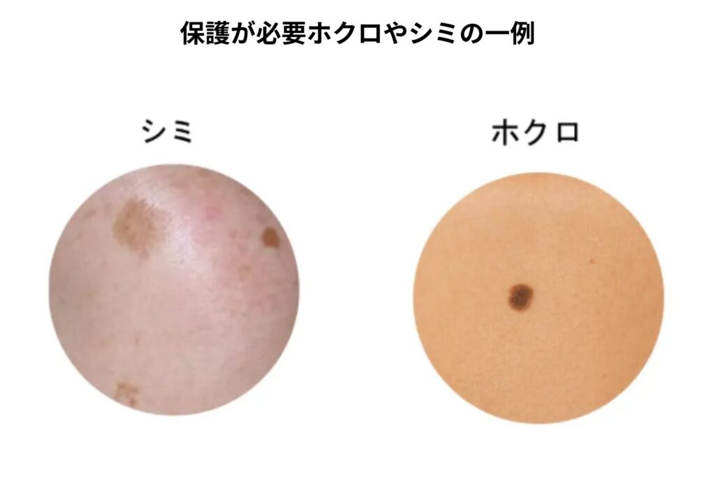 ほくろやシミがある場合