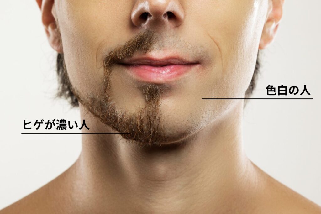 青髭が目立ちやすい人の特徴