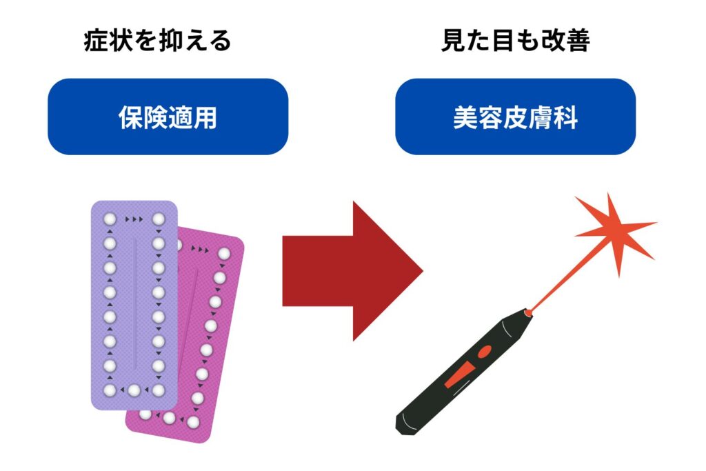 酒さと診断された場合の治療