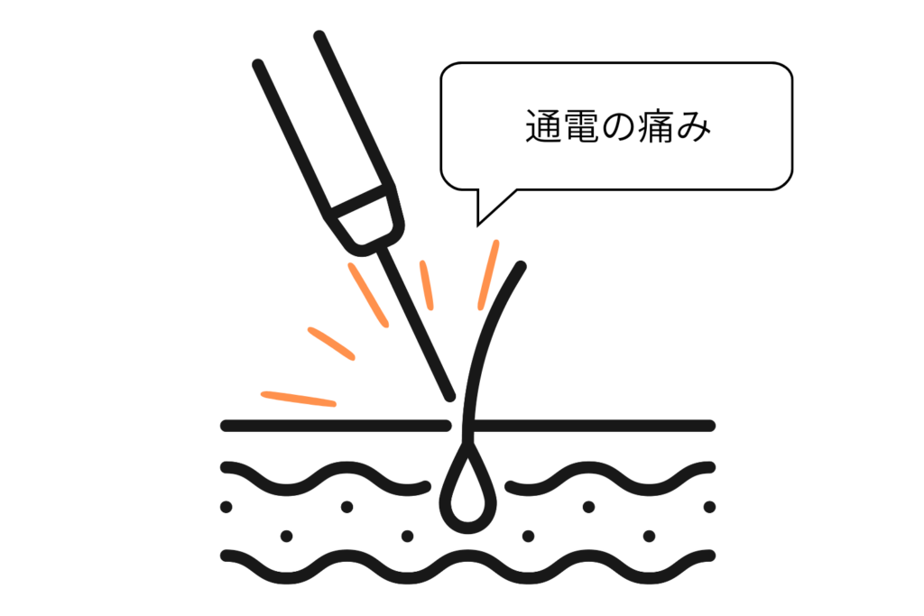 電気による熱が発毛組織の周囲へ伝わる