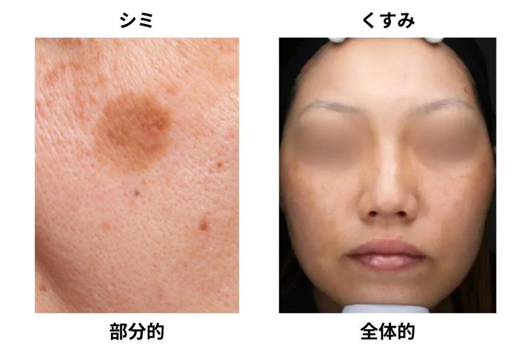 自分で見分けるには境界のはっきり具合を見る