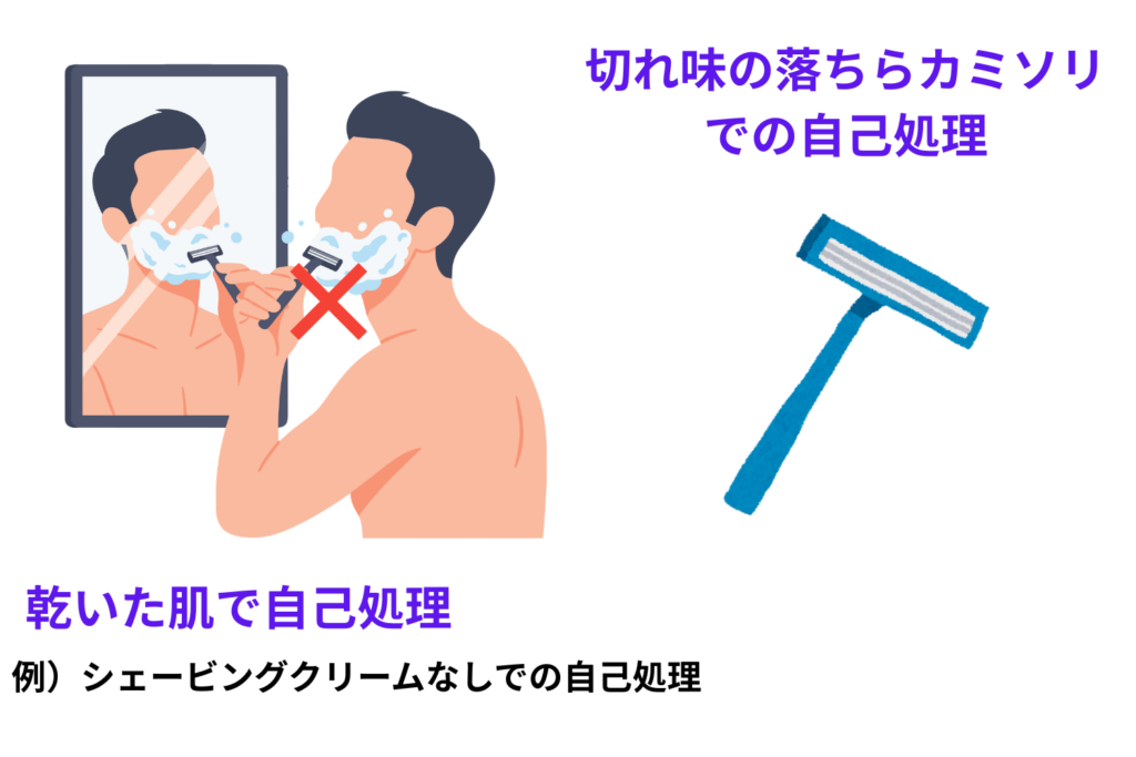 カミソリ負けが起こる主な原因