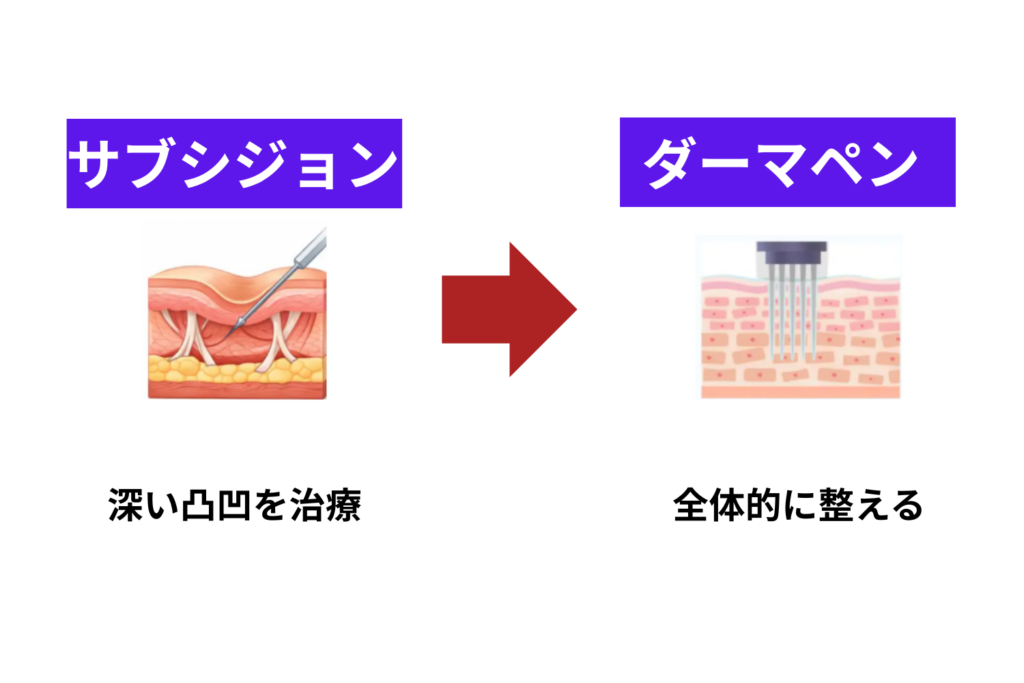 施術する順番はサブシジョンを先に行うことが多い