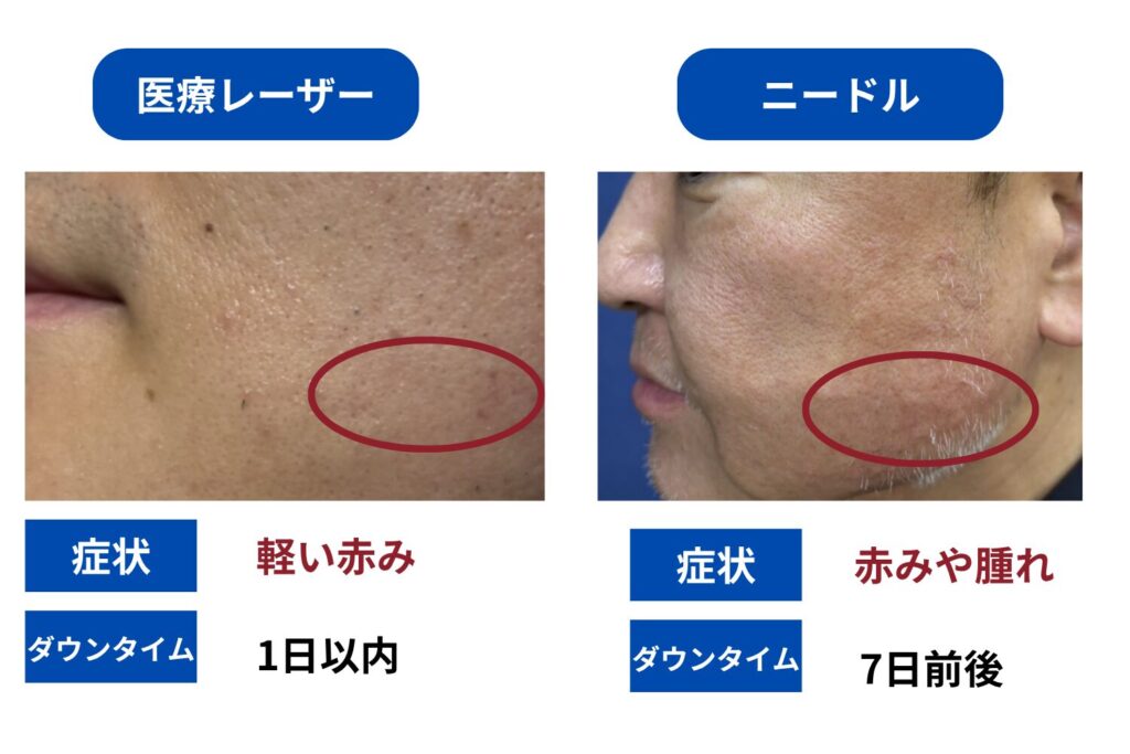 痛みとダウンタイム