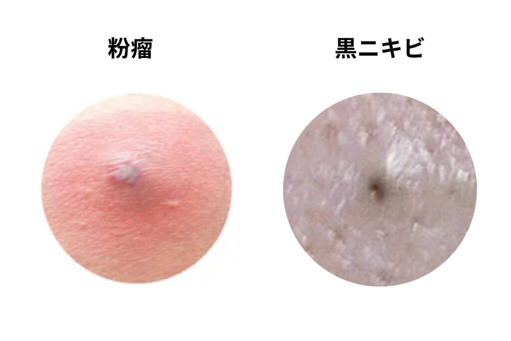 中央に黒い点があるか