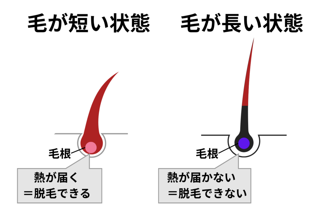 レーザーや光を毛根へ届けるため